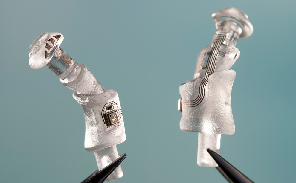 MikroBo - funktionalisierte Otoplastik